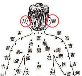 你的痣能否预示财富？探索神秘‘赚钱痣’的真相