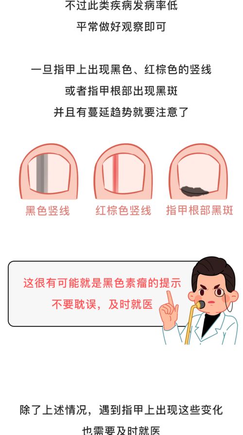 搓指甲也能成为副业？你不知道的赚钱新途径