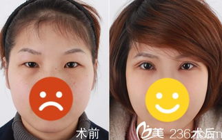 芘丽芙整形效果如何？芘丽芙美容医院事件真相究竟是什么？