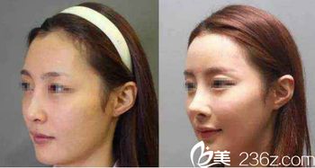 济南旭美整形效果如何？真实体验分享靠谱吗？