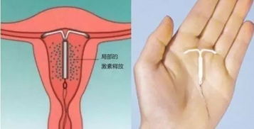 想通过卖学生耳饰盈利？具体操作步骤是怎样的？
