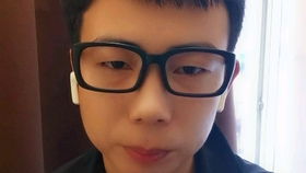 美瞳微商真的免费招代理？这样的机会你敢错过吗？